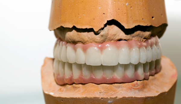 How Denture Adjustment Is Done